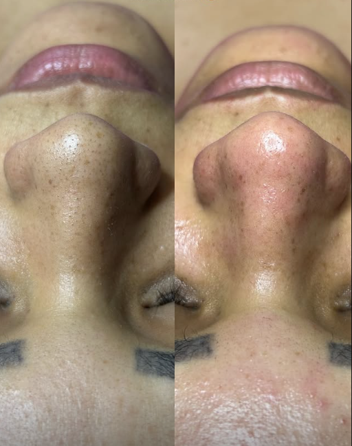 Resultado de tratamento estético 1